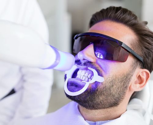 How do porcelain veneers work?